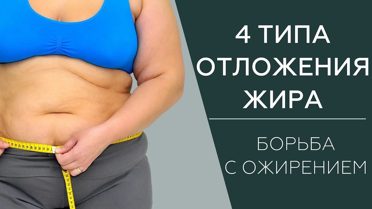 Типы ожирения | Как бороться с жиром | Стратегия для массажистов смотреть онлайн