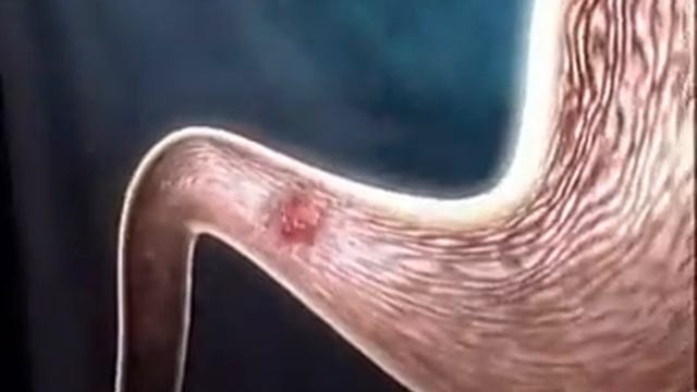 chimney helico 2 copy смотреть онлайн