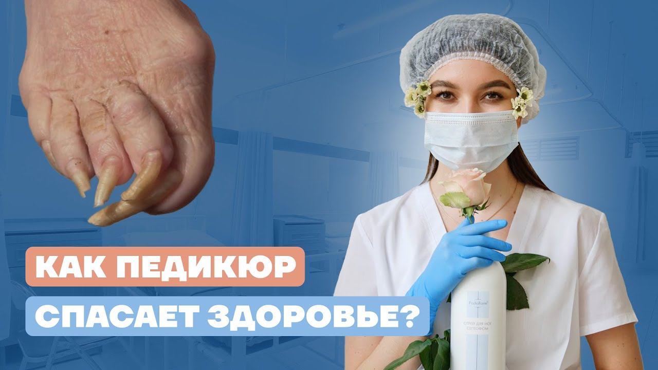 Вросший ноготь, грибок, трещины – когда педикюр уже не поможет?!