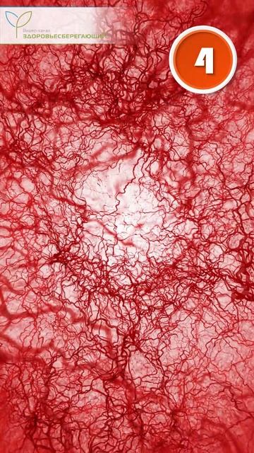 Как копеечное средство чистит сосуды и снижает холестерин? смотреть онлайн