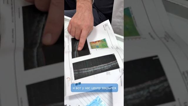 Детская травма глаза во время футбола. смотреть онлайн