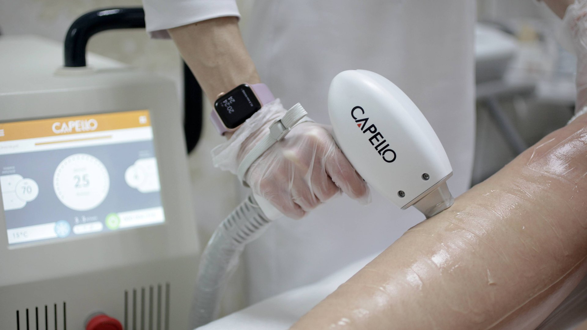 Лазерная эпиляция смотреть онлайн