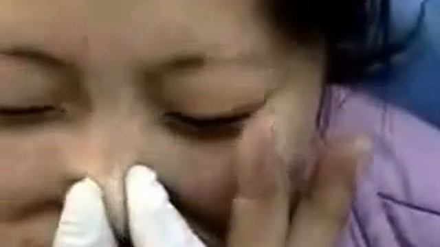 How to do a demodex mite test смотреть онлайн