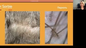 Трихологическая линия Dr.Sorbie