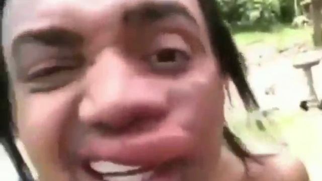 пчелы покусали