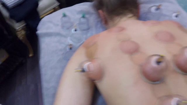 вакуумная терапия смотреть онлайн