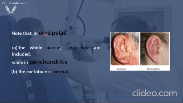 Anatomy & Physiology of ear, L1 & L2 - (Painful ear) - ENT смотреть онлайн