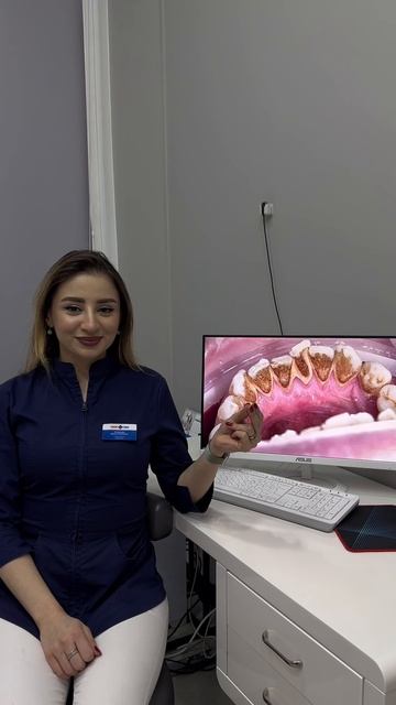 Чистка зубов: до/после смотреть онлайн