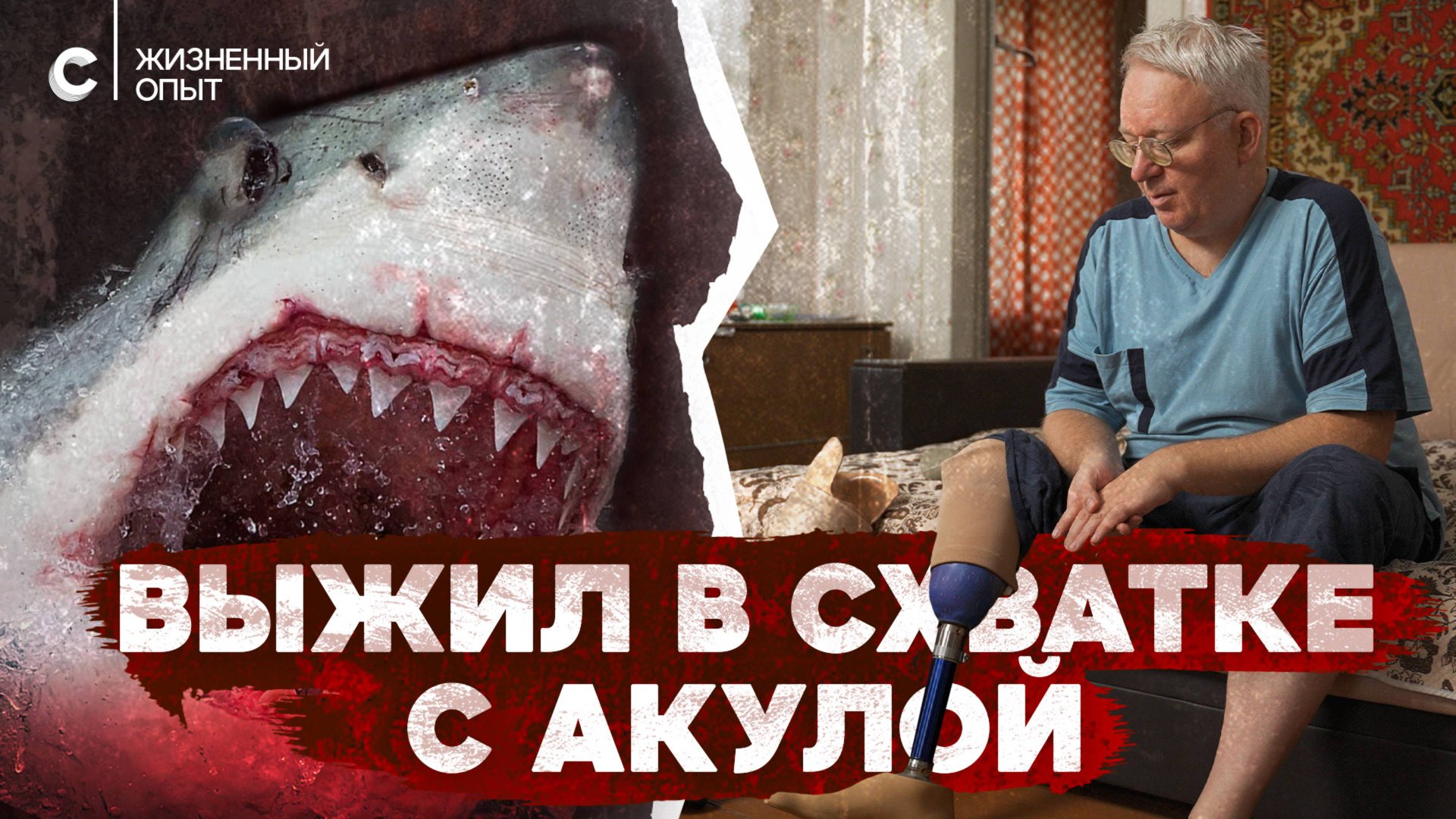 «Вместо ноги только кость торчит». Пережил нападение акулы смотреть онлайн