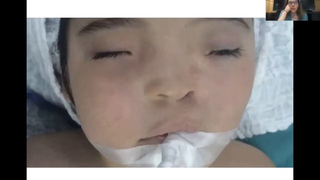 Reconstrucciones en Pediatría- Dra. Rosa Balcels смотреть онлайн