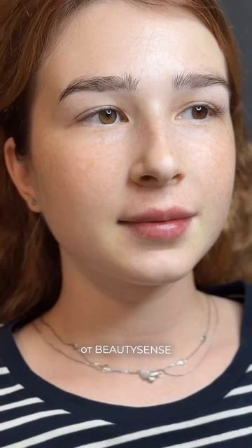 Какие эмоции вызывает у вас эта прекрасная девушка? 🤍 У нас такие красивые пациенты