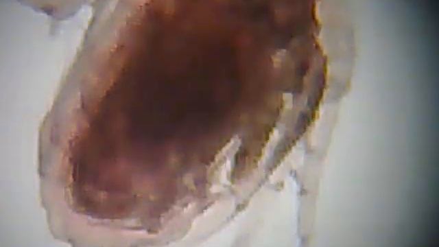 Daphnia pulex filtrando, organos internos смотреть онлайн