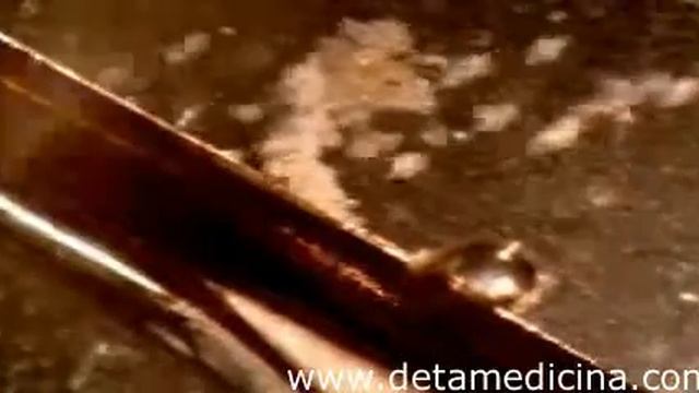 Воздействие приборов Deta на гибель бактерий, вирусов.mp4 смотреть онлайн