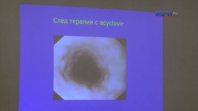 Откриване на Гастрофорум Варна 2015 смотреть онлайн