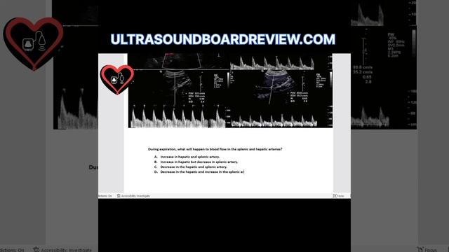 Celiac Artery Compression Syndrome, Dunbar Syndrome and Nutcracker Syndrome on Ultrasound смотреть онлайн