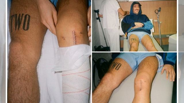 ManUtd News - Arsenal star Bellerin shows off horror 'Frankenstein' knee scar after surgery смотреть онлайн