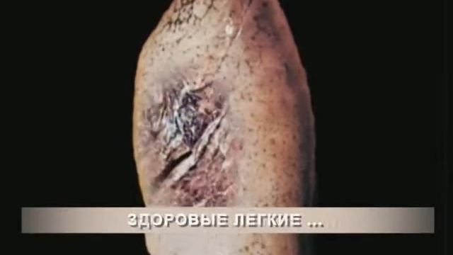 Об опасности курения (10 video заживо)