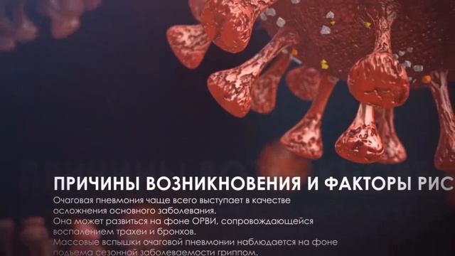 Очаговая пневмония стадии смотреть онлайн