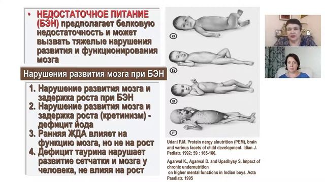 Развитие мозга и интеллекта у ребенка. Продукт: PEDIAKID Omega 3
