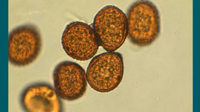 Diseases of Groundnut смотреть онлайн