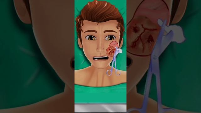 scar revision surgery||broken nose|| Surgery|| plastic surgery||ASMR||animation смотреть онлайн