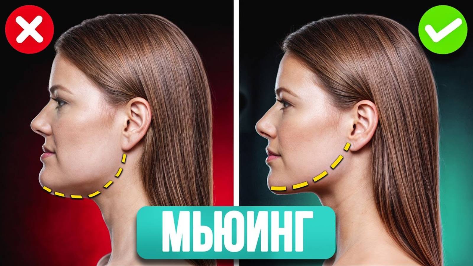 Работают ли упражнения для мьюинга? / Косметолог об идеальном овале лица смотреть онлайн