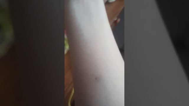 нам сегодня делали манту в школе смотреть онлайн