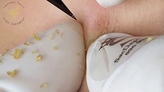 Make Your Day Satisfying With THUY TRUONG SPA New Videos #115