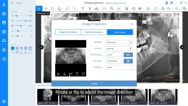 SMARTDent V3 - How to view and edit image information смотреть онлайн