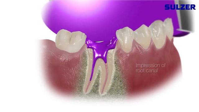 MIXPAC™ T-Mixer Colibri plus - One mixing tip, four indications смотреть онлайн