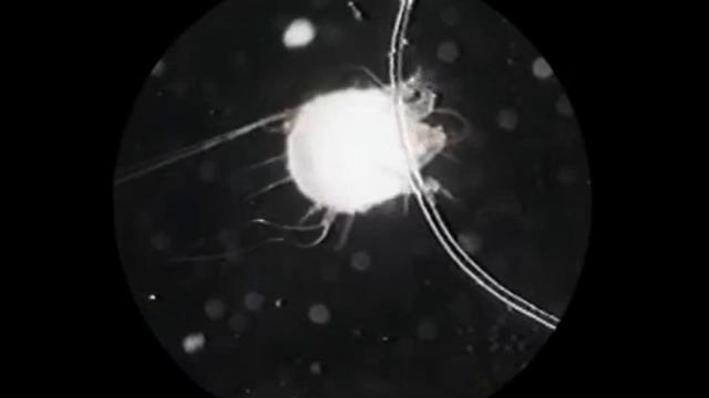 Biología del Psoroptes ovis (sarna ovina).wmv смотреть онлайн