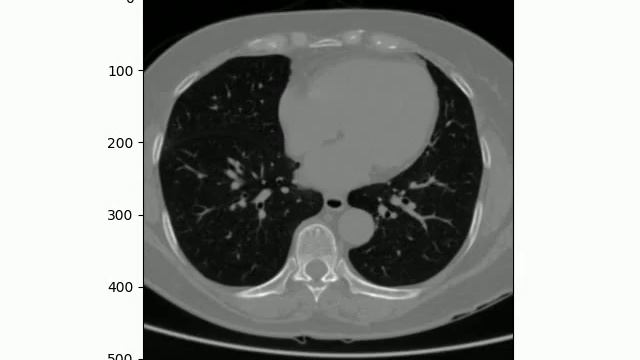 Heart segmentation from chest CT images using K-Means clustering and IP смотреть онлайн