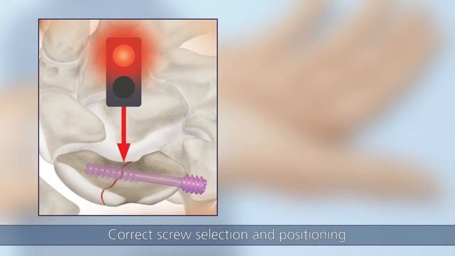 HBS 2 – Minimally invasive palmar surgical technique смотреть онлайн
