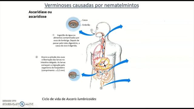 VERMINOSES смотреть онлайн
