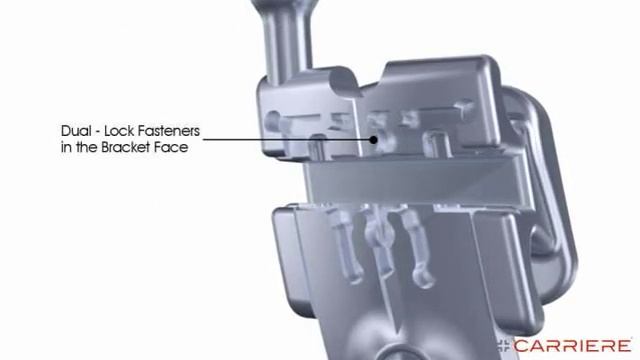 The Carriere System Self Ligating Bracket смотреть онлайн