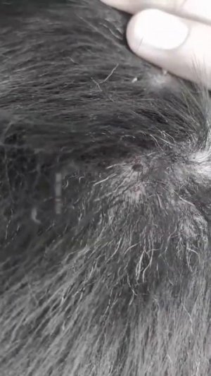 Clear All Ticks From Poor Dog In Countryside, Getting All Ticks Out From Dog #3, #shorts