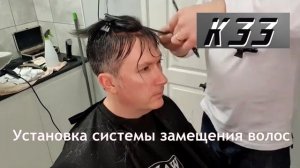 Установка системы замещения волос