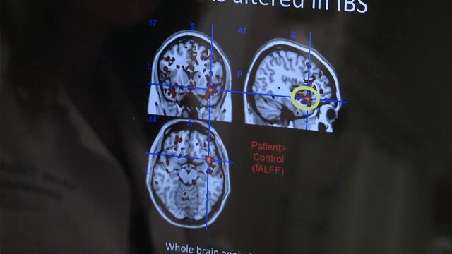 UCLA News|Week: Pain and the mind-brain-body link смотреть онлайн