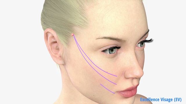 APTOS Excellense Visage смотреть онлайн
