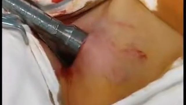 cervical part auto смотреть онлайн