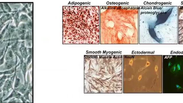 Manual Isolation Of Adipose-Derived Stem Cells From Human Lipoaspirates l Protocol Preview смотреть онлайн