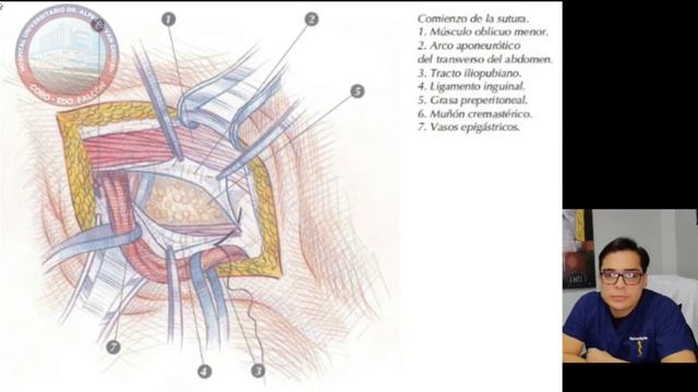 BASES ANATOMICAS DE LAS TÉCNICAS DE BASSINI Y SHOULDICE DE HERNIA INGUINAL смотреть онлайн