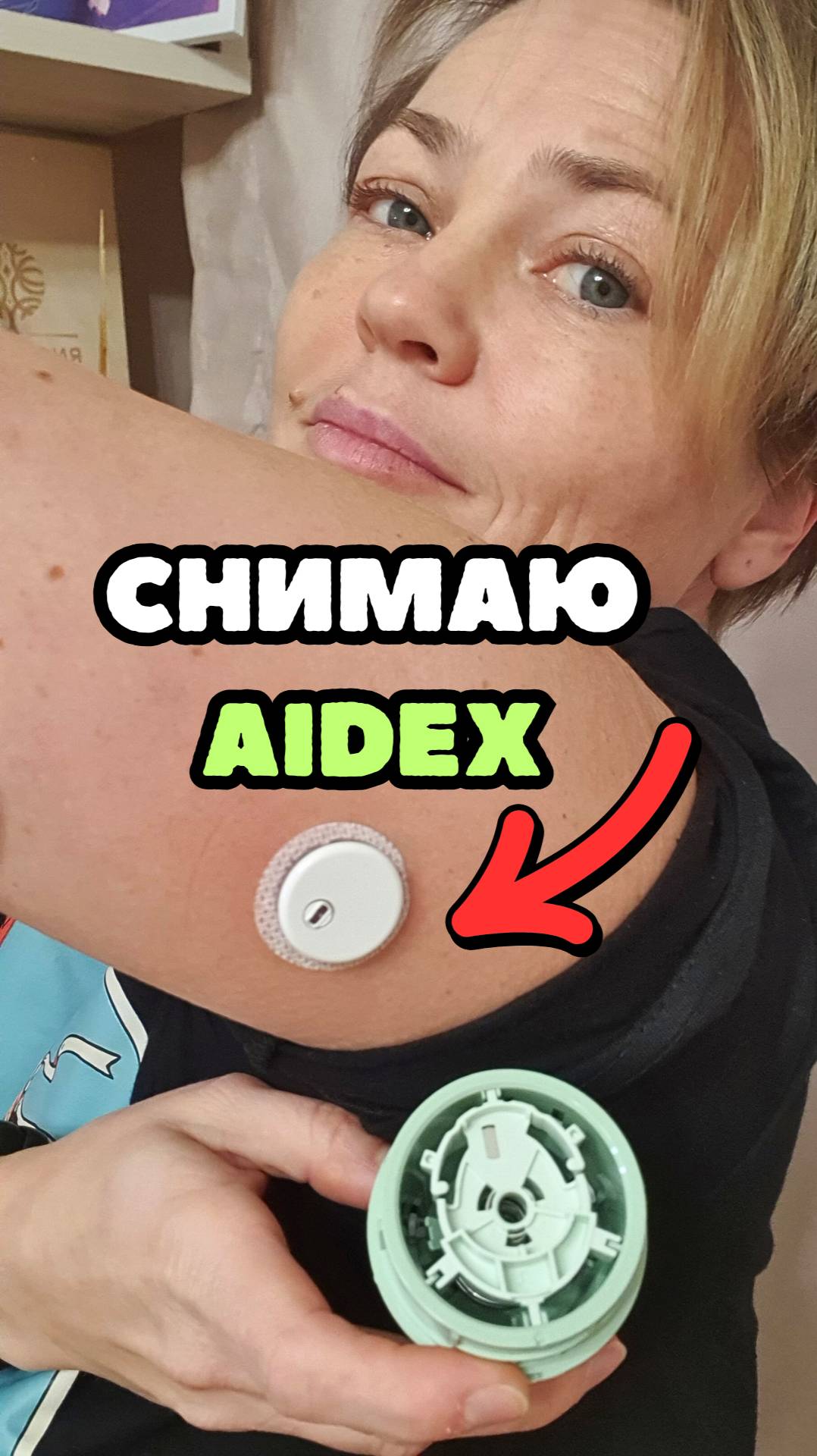 Снятие AIDEX // Диабет. Гаджеты смотреть онлайн