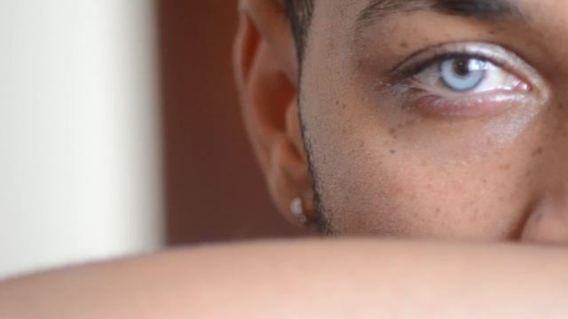 Bright Ocular Iris implants for-medical and cosmetic purposes смотреть онлайн