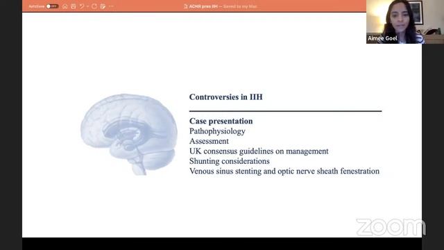 ACNS YNS Webinar - Oct 23 - Minimally Invasive Spine Surgery & IIH смотреть онлайн