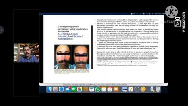 case taking derma смотреть онлайн