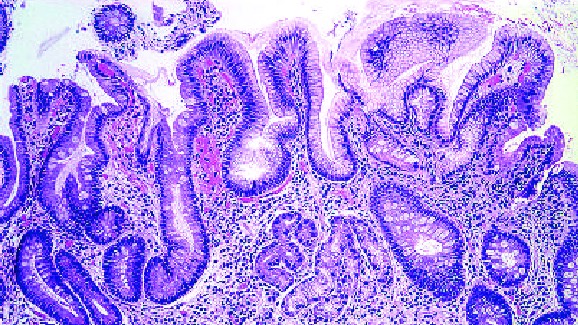 Патологическая анатомия заболеваний пищевода и желудка смотреть онлайн