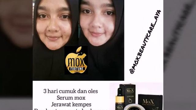 HP/WA 083114585752 Stokis Sabun dan Serum MoX Magelang смотреть онлайн