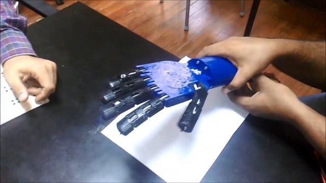 below elbow bionic hand смотреть онлайн