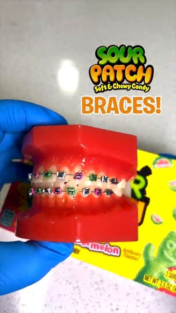 Candy You SHOULDN'T EAT As Braces! #Shorts смотреть онлайн